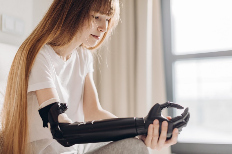 dziewczyna z protezą bioniczną